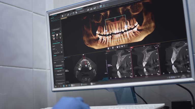 Oral Cancer Screening in Groton, SD